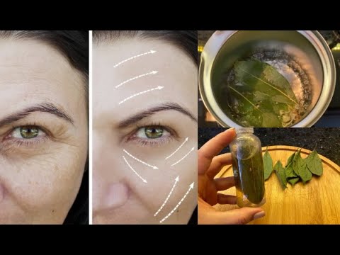 Video: Aloe Vera Grumbām: Vai Tas Var Palīdzēt Atbrīvoties No Smalkām Līnijām?