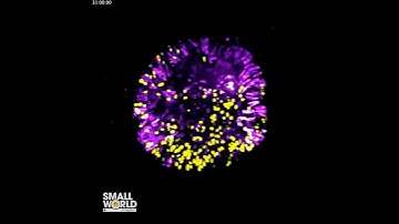 A Human Brain Organoid | 2023 #NikonSmallWorld #Microscopy