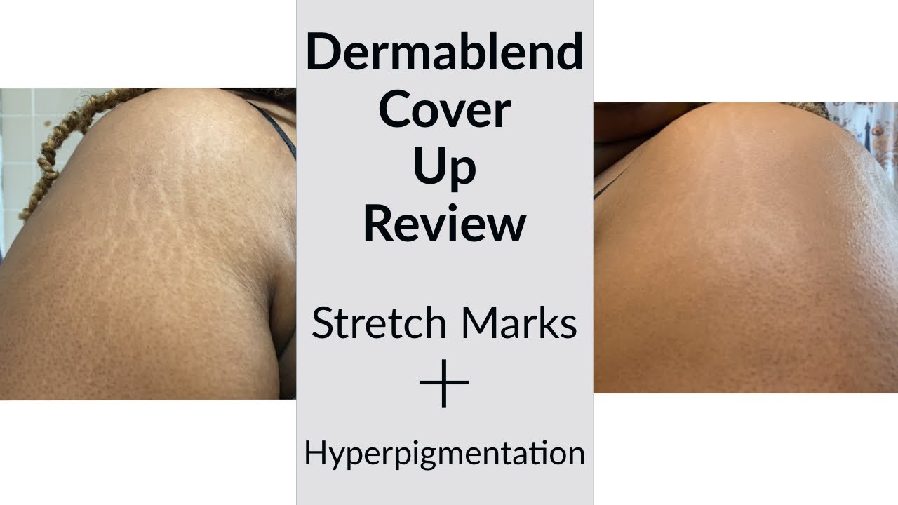 HOW TO COVER STRETCH MARKS ON ARMS WITH MAKEUP