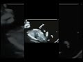 Dancing Baby#mother #shortsfeed #motherhood #pregnancy #pregnancyjourney #baby #fetaldevelopment