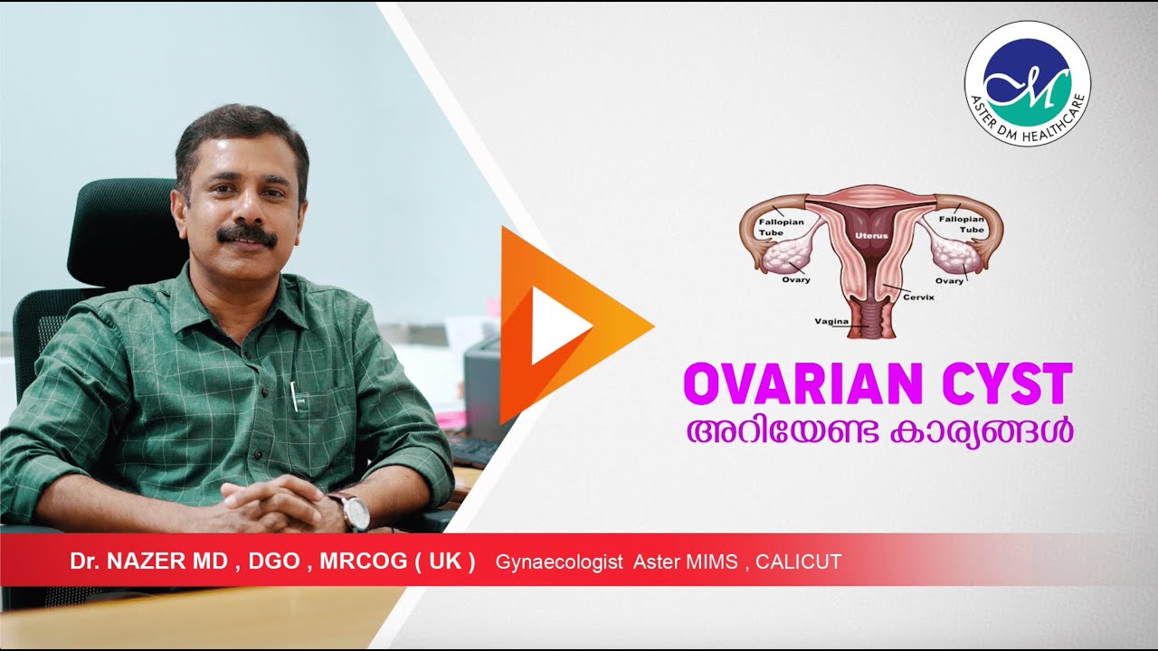 OVARIAN CYST ഒവേറിയൻ സിസ്റ്റ് അറിഞ്ഞിരിക്കേണ്ട കാര്യങ്ങൾ MALAYALAM