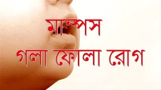 মাম্পস বা গলা ফোলা রোগ হলে করণীয়।