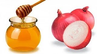 فوائد عصير البصل مع العسل المذهلة