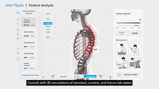 Moti Physio : Posture Analysis