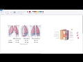 Thoracentesis quick review