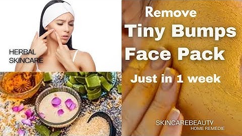 How to remove Tiny Bumps Naturally Face Pack (just in 1week)