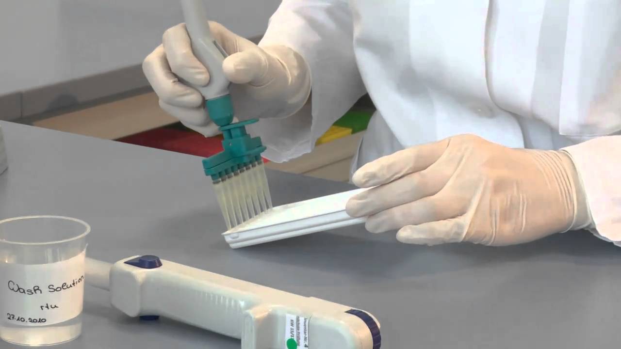 Immunoblot Test Systems: Laboratory Assays for Diagnosing Autoimmune ...