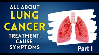 Lung Cancer Part 01 Dr Anshika Gupta SGPGIMS