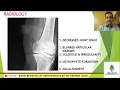 Osteoarthritis Clinico-Theoretical Module: Rapid Revision of Orthopaedics by Dr. Prateek Joshi