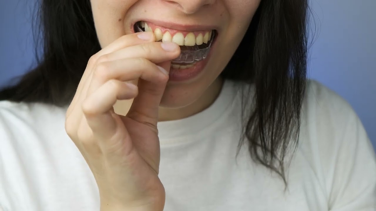 Anwendung der Knirscherschiene