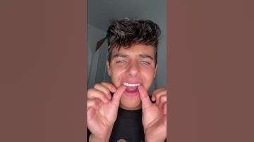 Kyle Thomas 💙 putting my retainers in after a MONTH!! 😭 #kylethomas #shorts