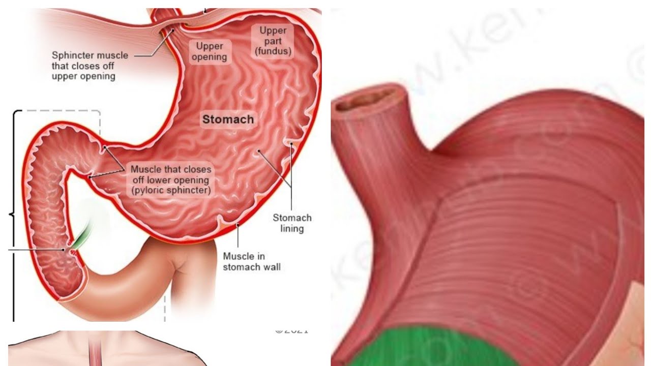IBYO KURYA BIKWIRIYE UMURWAYI W'IGIFU