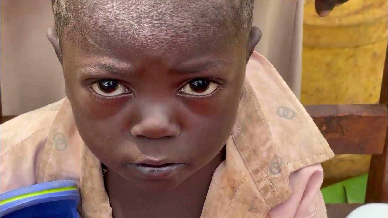 FREE VIDEO Jigger digging small Timothy's right foot YouTube