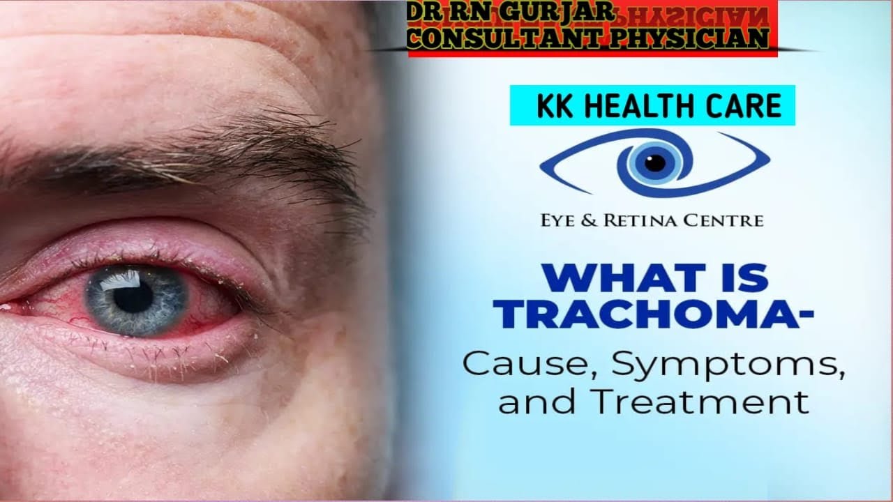 What is Trachoma? | Aankhon ki bimari jo Andhepan tak le ja sakti hai | 