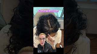 Coronal Incision| Brow Bone Reduction| Brow Lift| Plastic Surgery