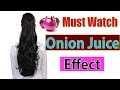 Onion Juice As a Treatment For Hair Loss | Hair Regrowth | Hindi