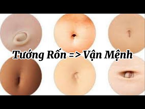 Nốt ruồi ở Rốn và hình dạng Rốn ảnh hưởng đến vận mệnh của bạn @Tứ Phủ Thần Điện