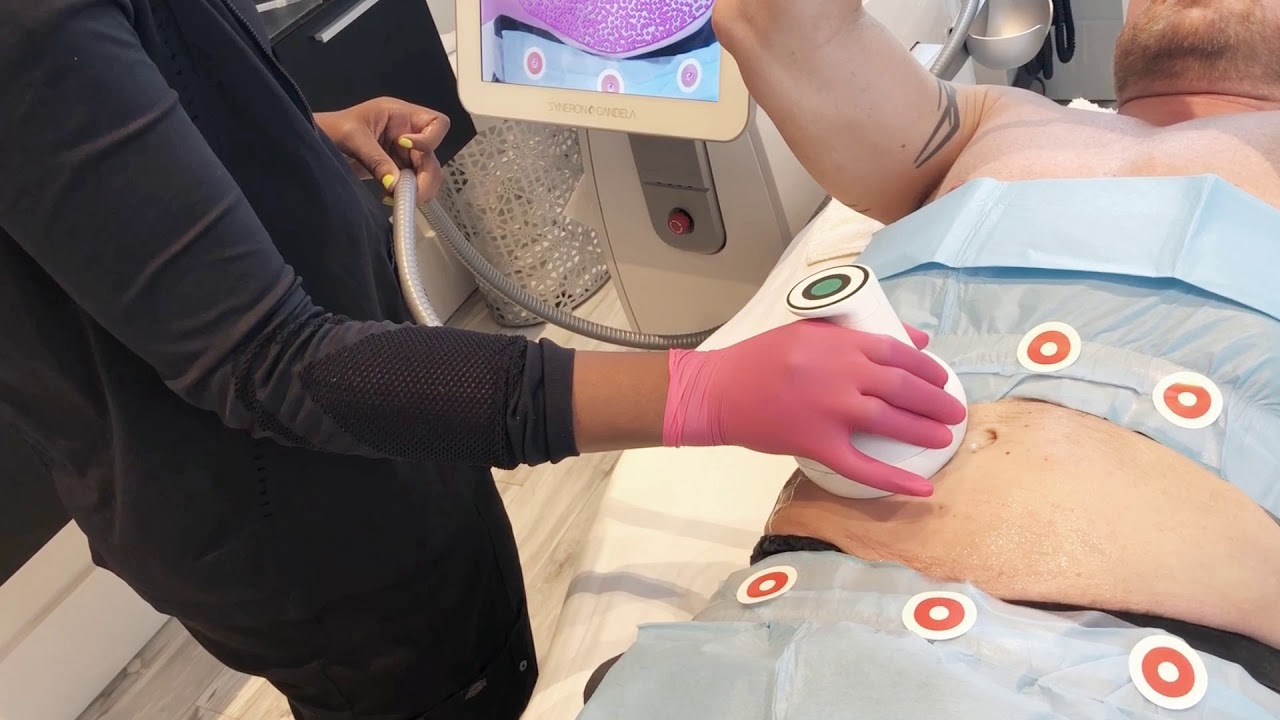 Ultrashape Power Non-Surgical Fat Destruction | The Aesthetic Medicine and Anti Aging Clinics |