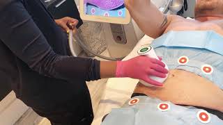 Ultrashape Power Non-Surgical Fat Destruction | The Aesthetic Medicine and Anti Aging Clinics |