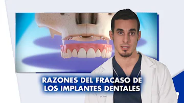 ¿Cuál es la principal causa de fracaso de los implantes dentales?