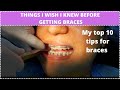 TOP 10 Tips for Braces | I wish I these tips before getting braces