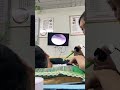 耳垢そうじ/耳が痒くなった鼓膜に付着した軟耳垢/ #shorts