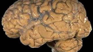 Problem solving | Wikipedia audio article
