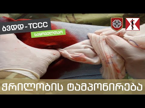 5. მასიური სისხლდენის კონტროლი - ჭრილობის ტამპონირება - [MARCH - M]