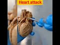 Heart attack मैं क्या होता है#shorts #heart #heartattack#
