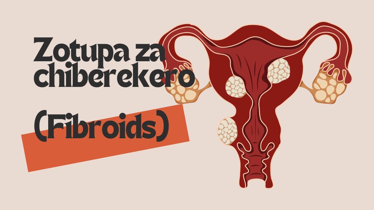 Fibroids (Chichewa)