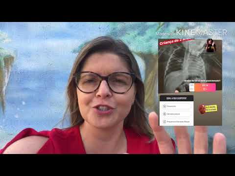 Vídeo: Diferença Entre Derrame Pleural E Pneumonia