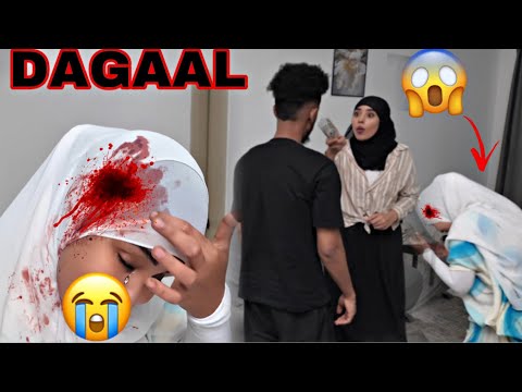 DAGAAL ANIGA IYO XANAAN DHAAWAC MADAXA KASOO GAARAY CEYDA OO IGU XANAAQAY