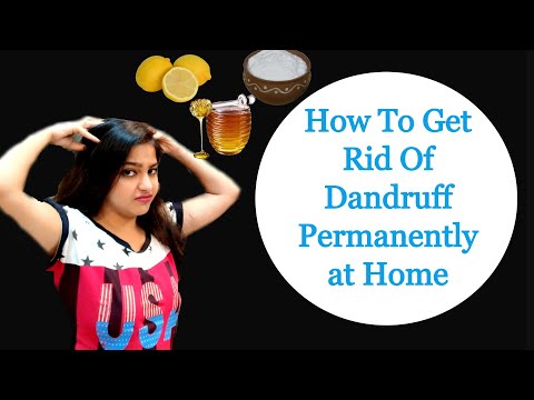 how-to-get-rid-of-dandruff-permanently-at-home-|-home-remedy-for-dandruff-and-itchy-scalp|-joyofrims