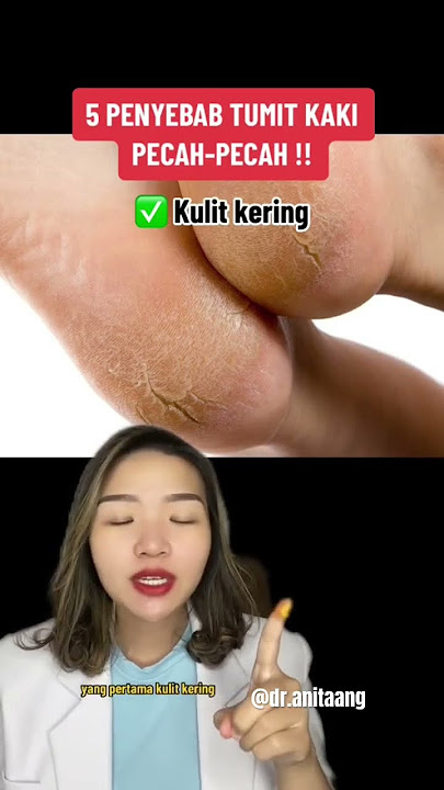 PENYEBAB TUMIT KAKI PECAH-PECAH! #kakipecahpecah #skincaretips #skintips #aestheticdoctor #skincare
