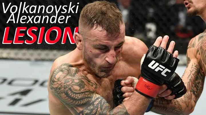 THE ONLY Alex Volkanovski LOSS in MMA (to Corey Ne...