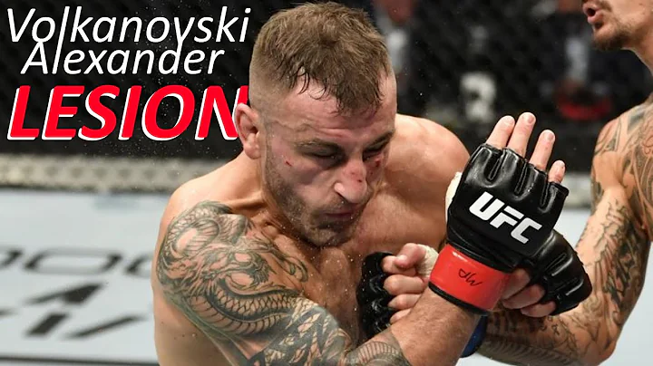 THE ONLY Alex Volkanovski LOSS in MMA (to Corey Ne...