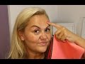 HOW I'M DEALING WITH MY PIGMENTATION | CAROLINE HIRONS | MAY 2017