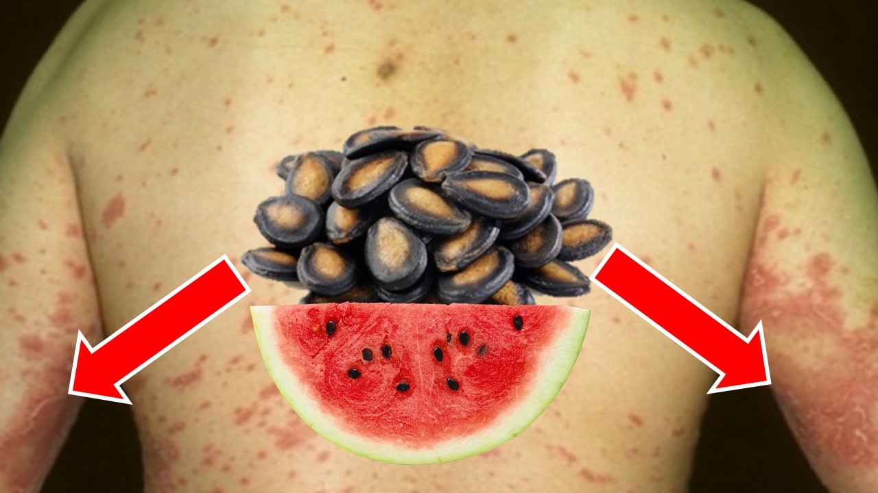 Take Watermelon Seeds And Boil Them The Results Will Shock You YouTube