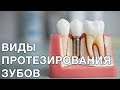 Протезирование зубов. Виды протезирования зубов. Микро протезирование.