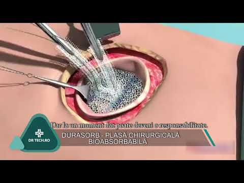 Durasorb - Plasă chirurgicală bioabsorbabilă - DrTech.ro