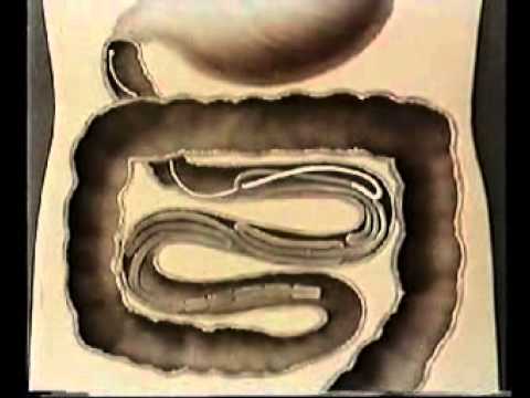 Зоология: Ленточные черви