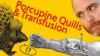 Blood transfusion using porcupine quills in the 1660s