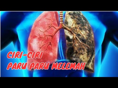 Tanda tanda Ini Menunjukkan Paru paru kita melemah yang harus kita waspadai