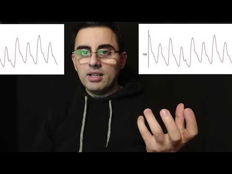 ალტერნაციული პულსი