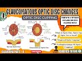 GLAUCOMA | OPTIC DISC CHANGES | POAG | OPHTHALMOLOGY | MBBS #ophthalmology #mbbslectures #glaucoma 