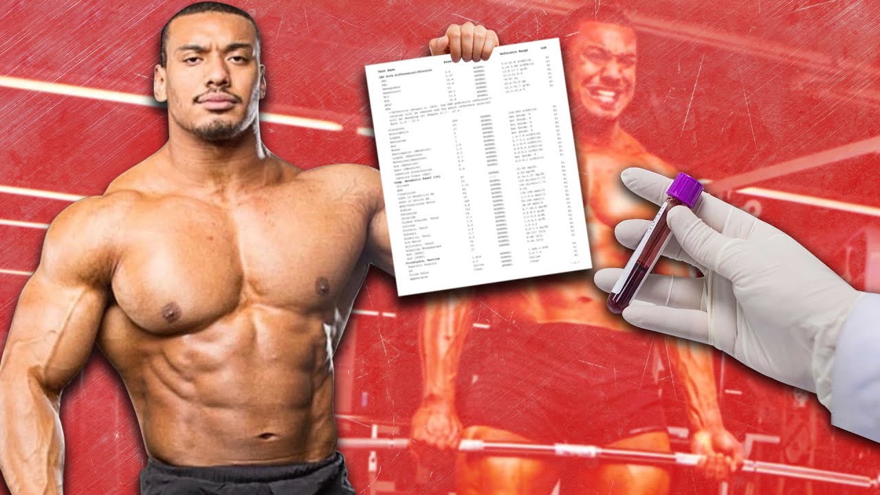 Reacting To Larry Wheels Blood Work