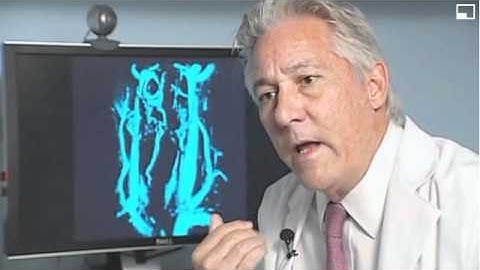 Dr. Hubbard CCSVI Interview ABC 10 - San Diego - Part 1