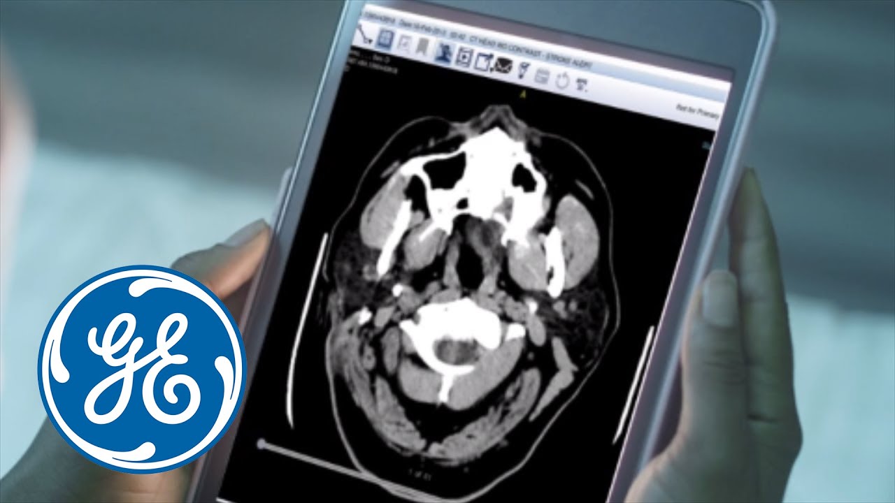 GE Healthcare Centricity Universal Viewer Zero Footprint | GE Healthcare