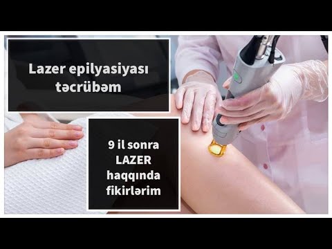 9 illik Lazer Epilyasiyası təcrübəm. Aleksandrit Lazer elətdirməyə dəyərmi?