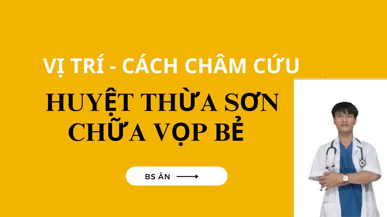 Bấm huyệt Thừa sơn chữa Vọp bẻ ( chuột rút ) tay chân... - youtube